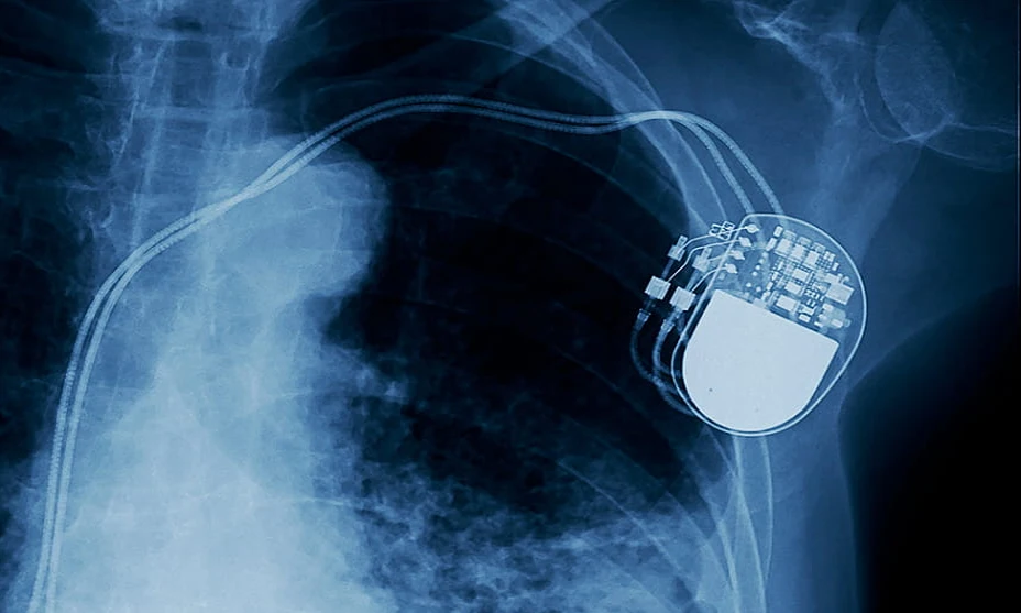 Implantable and Subdermal Devices